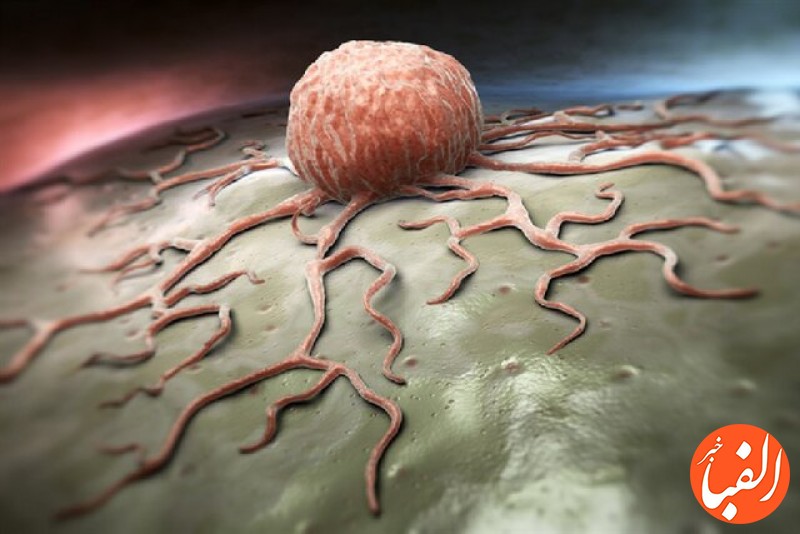 سرطان-پانکراس-فعالیت-متابولیک-سلول-ها-را-می-دزدد