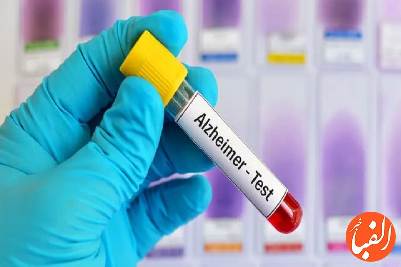 نتایج-امیدبخش-نوعی-آزمایش-خون-در-تشخیص-آلزایمر