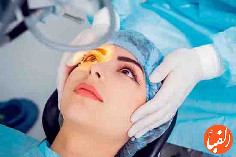 آیا-جراحی-چشم-شامل-بیمه-تکمیلی-می-شود