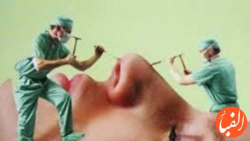کاهش-سن-جراحی-بینی-در-ایران-افزایش-تقاضای-مردان-برای-جراحی-زیبایی