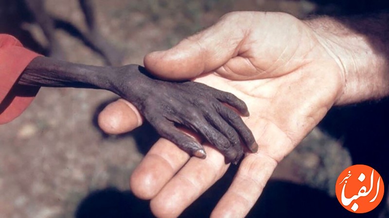 تصویر-دست-گرسنه-جهانی-شد