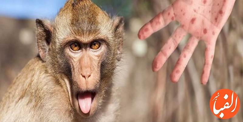 جهش-غیر-عادی-و-سریع-ویروس-آبله-میمونی