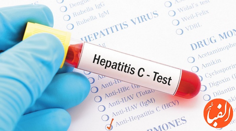 هپاتیت-به-سادگی-منتقل-می-شود-علائم-خطرناک-این-ویروس-را-بیشتر-بشناسید