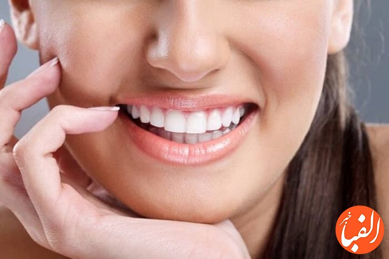 کامپوزیت-دندان-چگونه-باعث-اصلاح-طرح-لبخند-می-شود