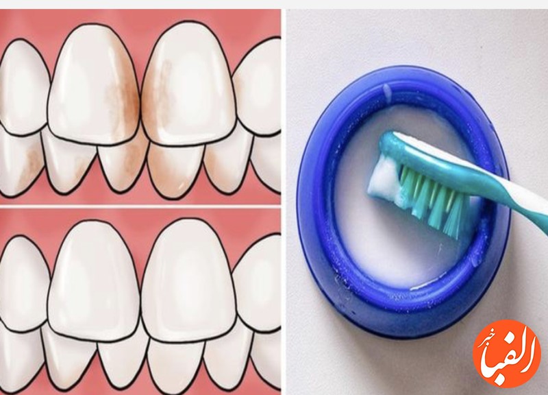 راهکار-هایی-ساده-برای-داشتن-دندان-هایی-سالم-تر-و-زیباتر